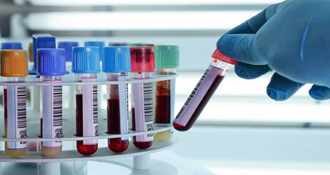 Pieve di Cadore. Morto per uno scambio di persona: accusa d’omicidio per i medici.