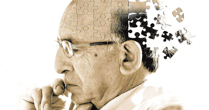 Alzheimer